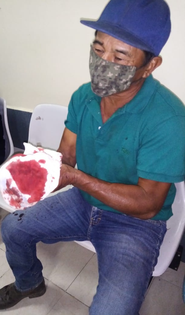 El hombre fue atacado por dos sujetos, uno portaba un cuchillo con el que lo lesionó El hombre fue atacado por dos sujetos, uno portaba un cuchillo con el que lo lesionó