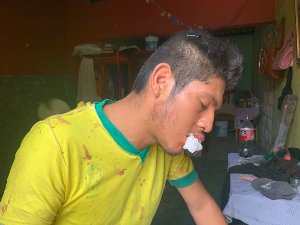 EL joven fue auxiliado por dos personas quienes le ayudaron levantarse EL joven fue auxiliado por dos personas quienes le ayudaron levantarse