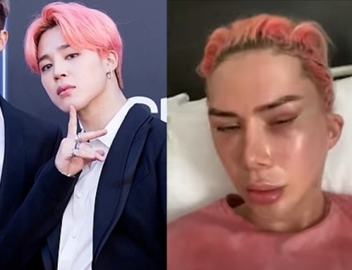 Joven asume la identidad de coreano tras hacerse cirugías para parecerse a Jimin de BTS