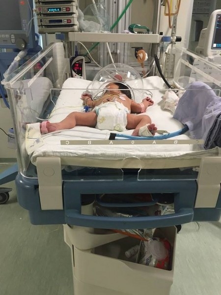 Los bebés tienen síntomas como dolor, tos, fiebre mayor a 39 grados e irritación de garganta; otros son diarrea y vómito
