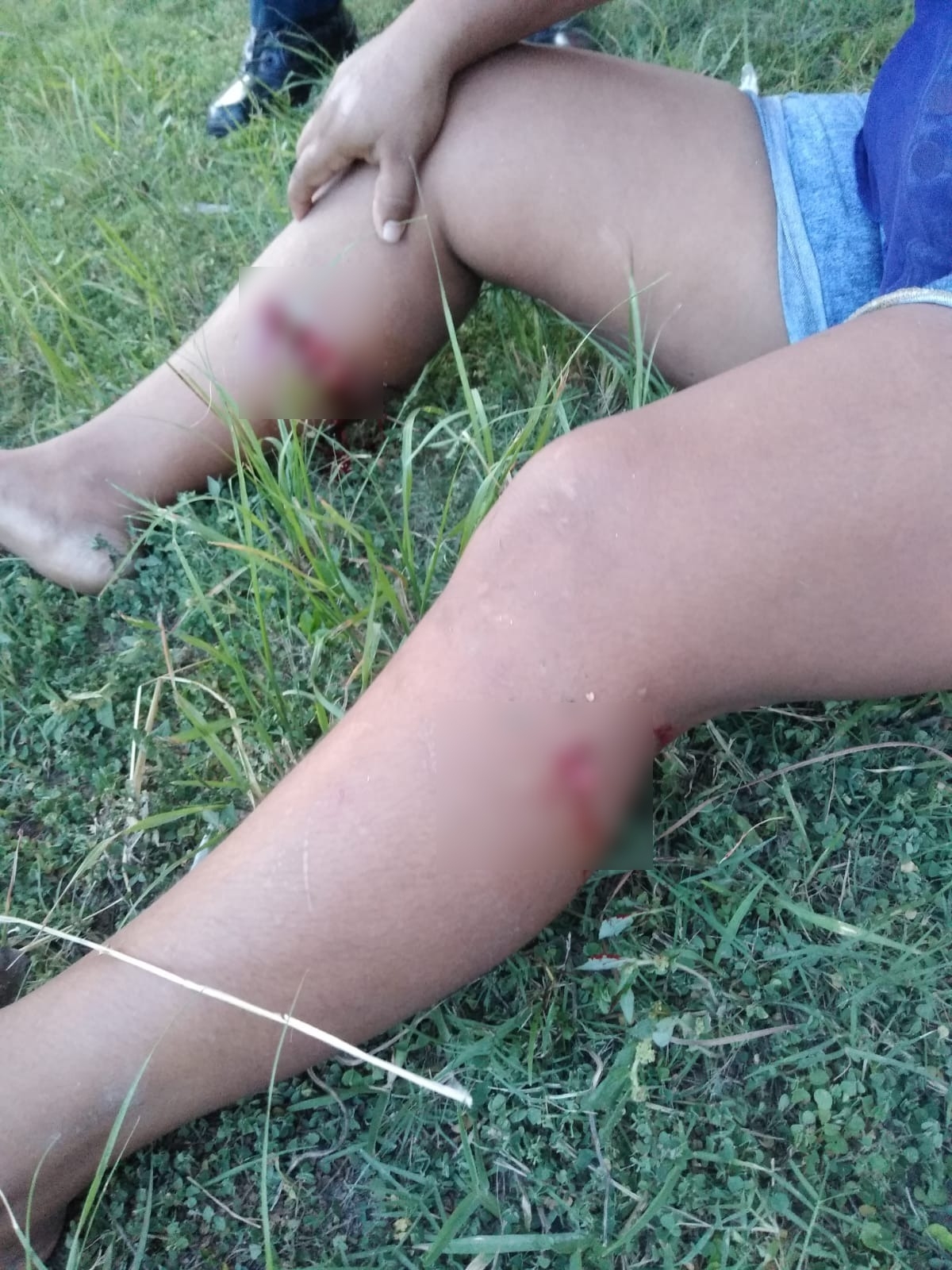 La joven mamá tuvo que se trasladada al Hospital General de Cozumel debido a la gravedad de las heridas La joven mamá tuvo que se trasladada al Hospital General de Cozumel debido a la gravedad de las heridas