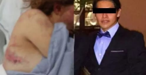El pasado 8 de noviembre de 2108 Christian Contreras golpeó salvajemente a su novia El pasado 8 de noviembre de 2108 Christian Contreras golpeó salvajemente a su novia