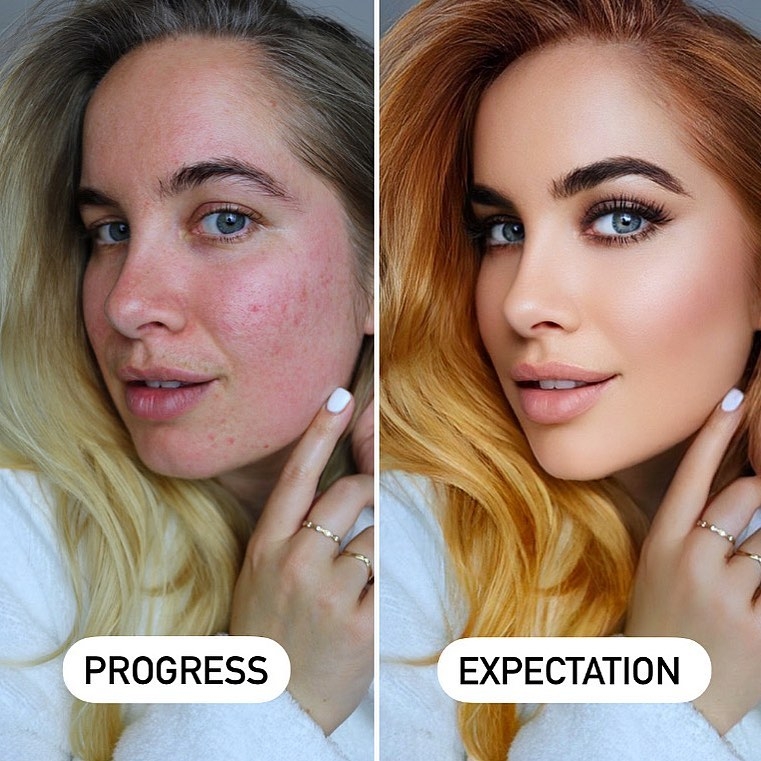 Joanna no teme mostrarse ante sus miles de seguidores con todas y cada una de sus imperfecciones