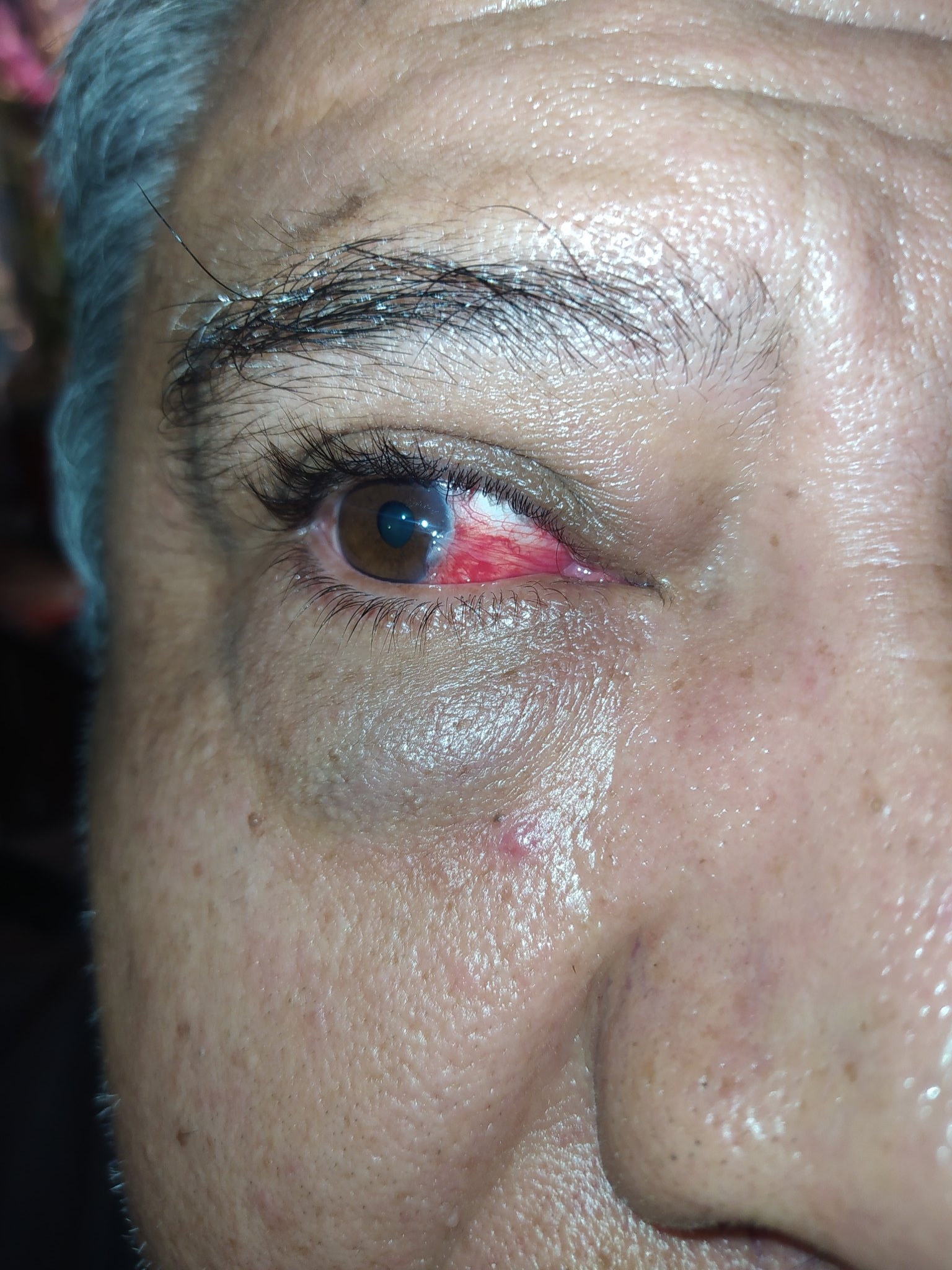 El suegro de la denunciante, un hombre mayor puede perder la visión debido a que le desprendieron la retina durante la golpiza policial