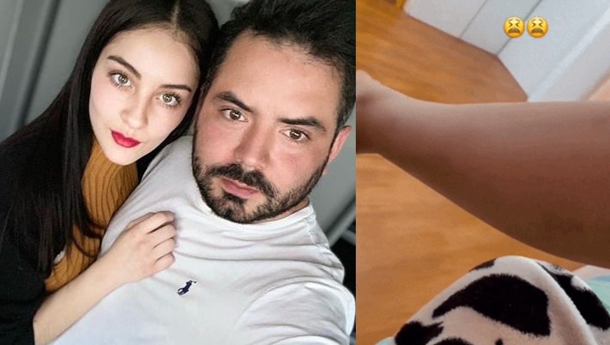 Novia de José Eduardo Derbez muestra fuerte accidente en motocicleta: FOTOS