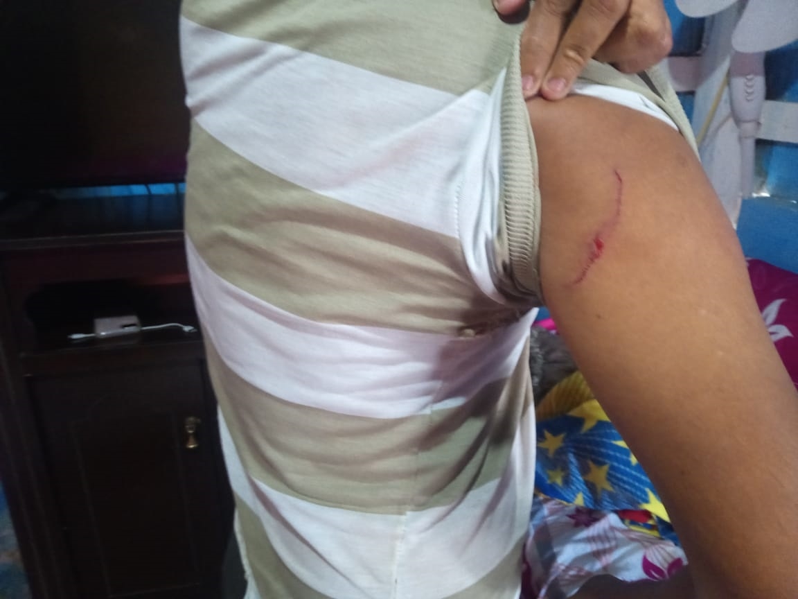 Hirieron a una de sus víctimas con arma blanca para revelar dónde se encontraba el dinero Hirieron a una de sus víctimas con arma blanca para revelar dónde se encontraba el dinero