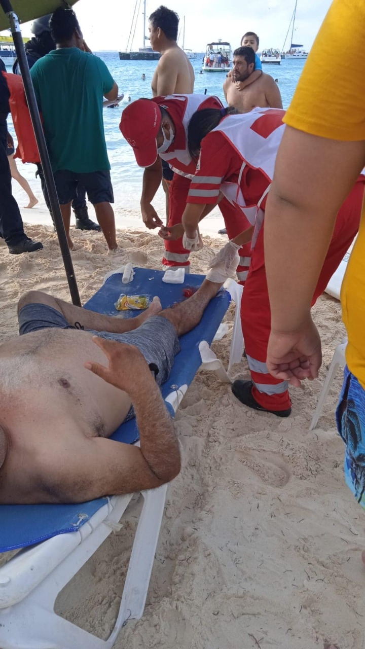 Este visitante perdió el meñique derecho y se lesionó el siguiente dedo al ser prensado entre la moto y el bote Este visitante perdió el meñique derecho y se lesionó el siguiente dedo al ser prensado entre la moto y el bote