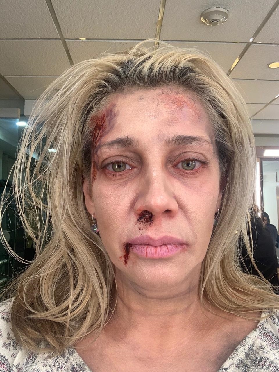 Cynthia Klitbo dijo que su matrimonio con el hombre, le causó un gran daño psicológico Cynthia Klitbo dijo que su matrimonio con el hombre, le causó un gran daño psicológico