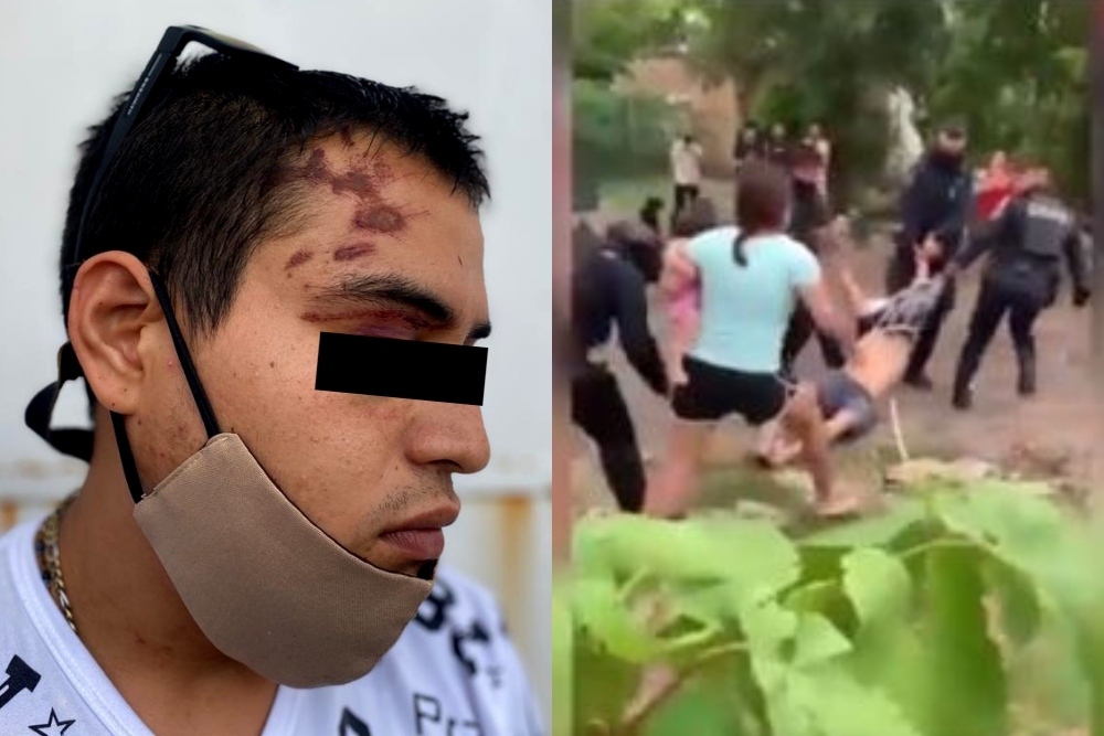 El agraviado mostró los moretones y heridas en su cuerpo tras la golpiza dada por policías estatales en Cancún El agraviado mostró los moretones y heridas en su cuerpo tras la golpiza dada por policías estatales en Cancún