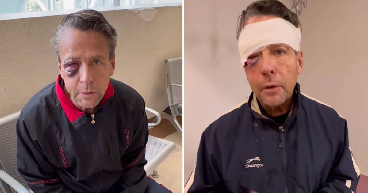 En la grabación se le ve al actor dando la primera patada contra dos hombres que posteriormente lo golpearon En la grabación se le ve al actor dando la primera patada contra dos hombres que posteriormente lo golpearon