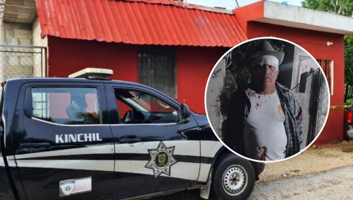El hombre presentó heridas en la cabeza tras la agresión de un policía de Kinchil El hombre presentó heridas en la cabeza tras la agresión de un policía de Kinchil