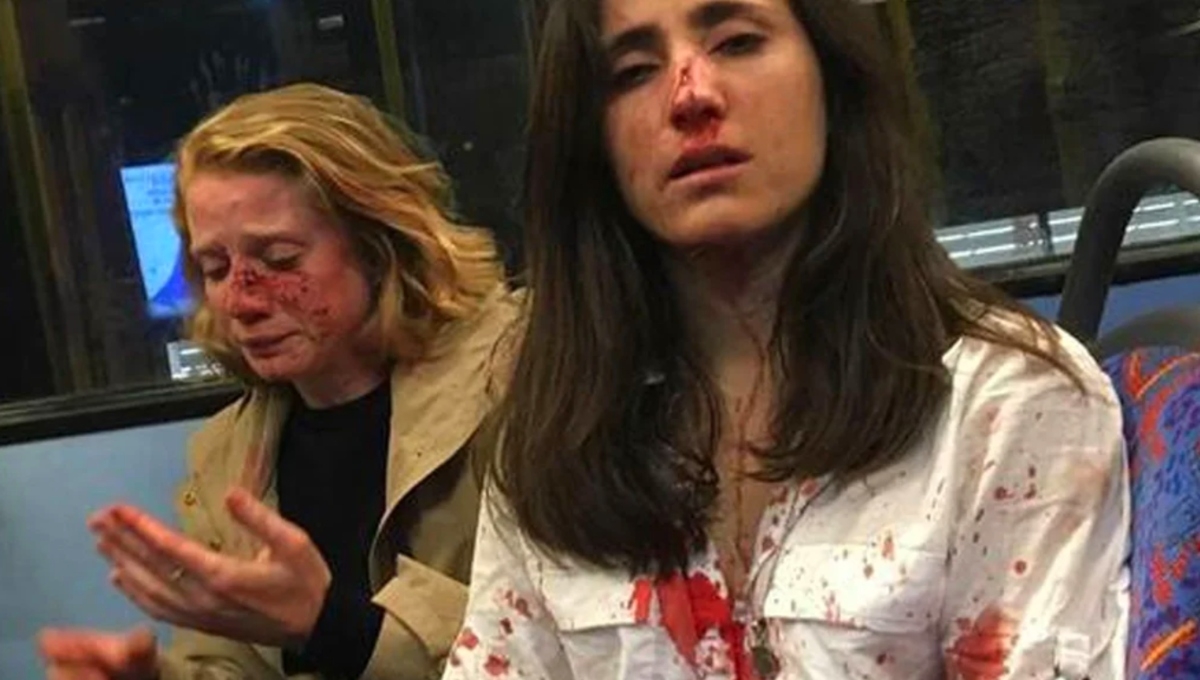 En redes sociales circula un video donde una joven uruguaya, aspirante a médica, se muestra con el rostro cubierto de sangre junto con la estadounidense Christine Hannigan En redes sociales circula un video donde una joven uruguaya, aspirante a médica, se muestra con el rostro cubierto de sangre junto con la estadounidense Christine Hannigan