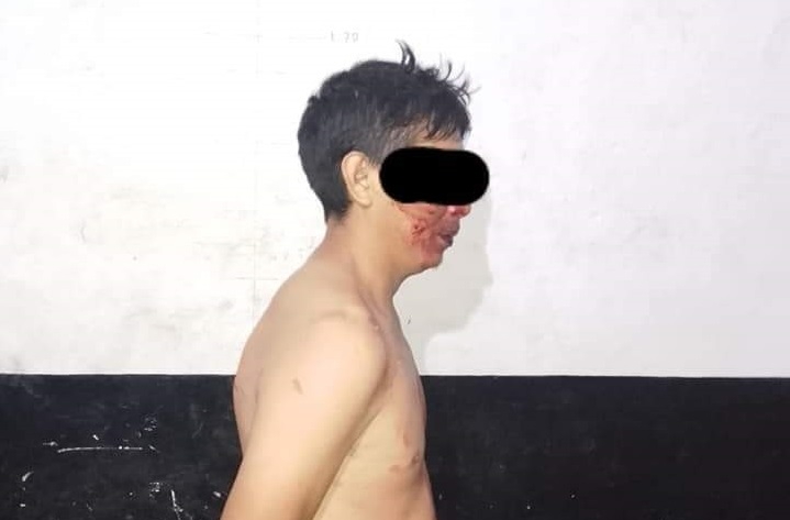 Hombre golpeó a su esposa e intentó incendiar su casa en Ticul