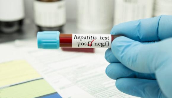 Tamaulipas analiza el primer caso de hepatitis infantil en México