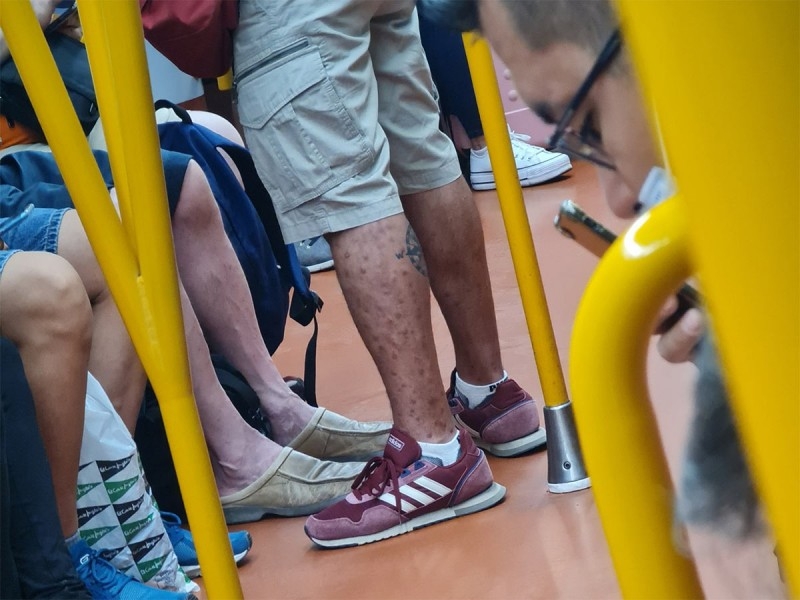 De acuerdo a los especialistas, los contagiados con viruela del mono deben aislarse. Foto: Twitter