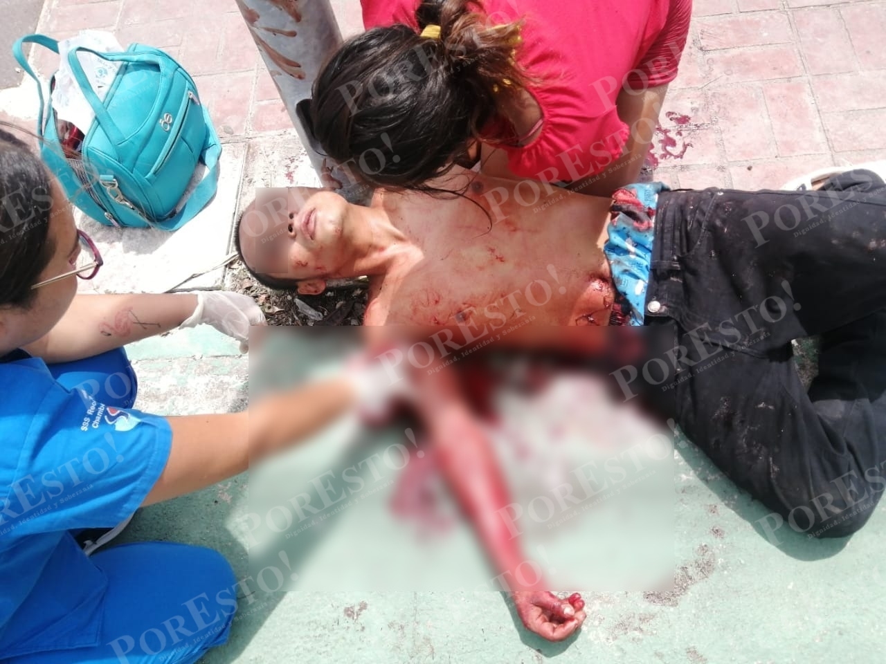 El joven que se lastimó con un cristal en Cozumel fue atendido por paramédicos y llevado a un hospital de la ciudad