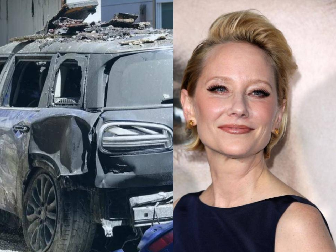 Anne Heche fue rescatada luego de una hora para controlar las llamas, por lo que sufrió quemaduras tras el accidente Anne Heche fue rescatada luego de una hora para controlar las llamas, por lo que sufrió quemaduras tras el accidente
