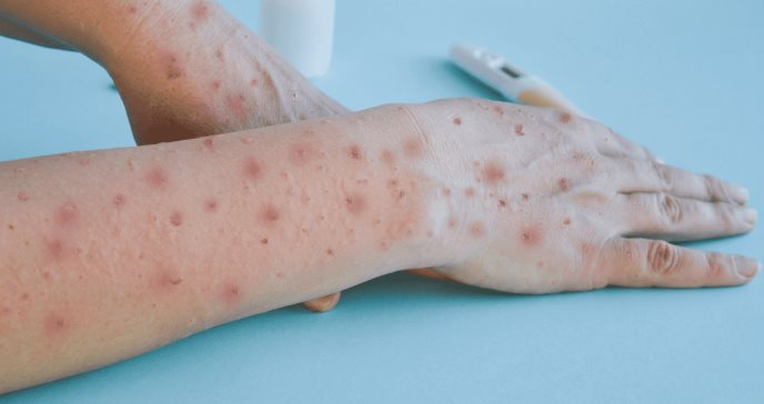 Es necesario mantener medidas preventivas como lavado frecuente de manos con agua y jabón y uso correcto de cubrebocas