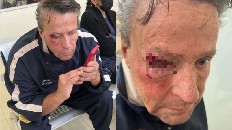 Alfredo Adame acaba de sufrir brutal golpiza fuera de su casa, y confesó que ha sufrido grave lesión en uno de sus ojos