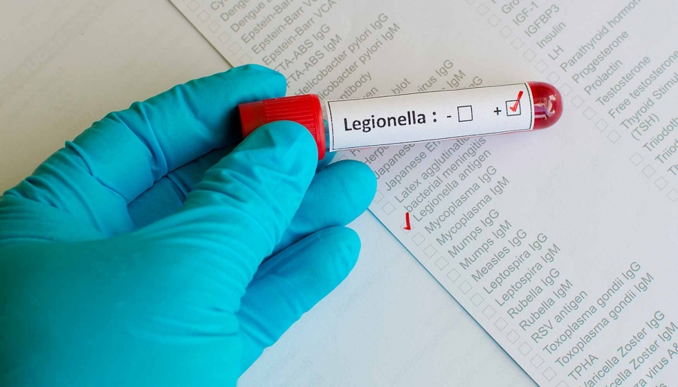 El brote de legionella en Argentina se dio en un hospital en Tucumán, afectando en su mayoría al personal de Salud