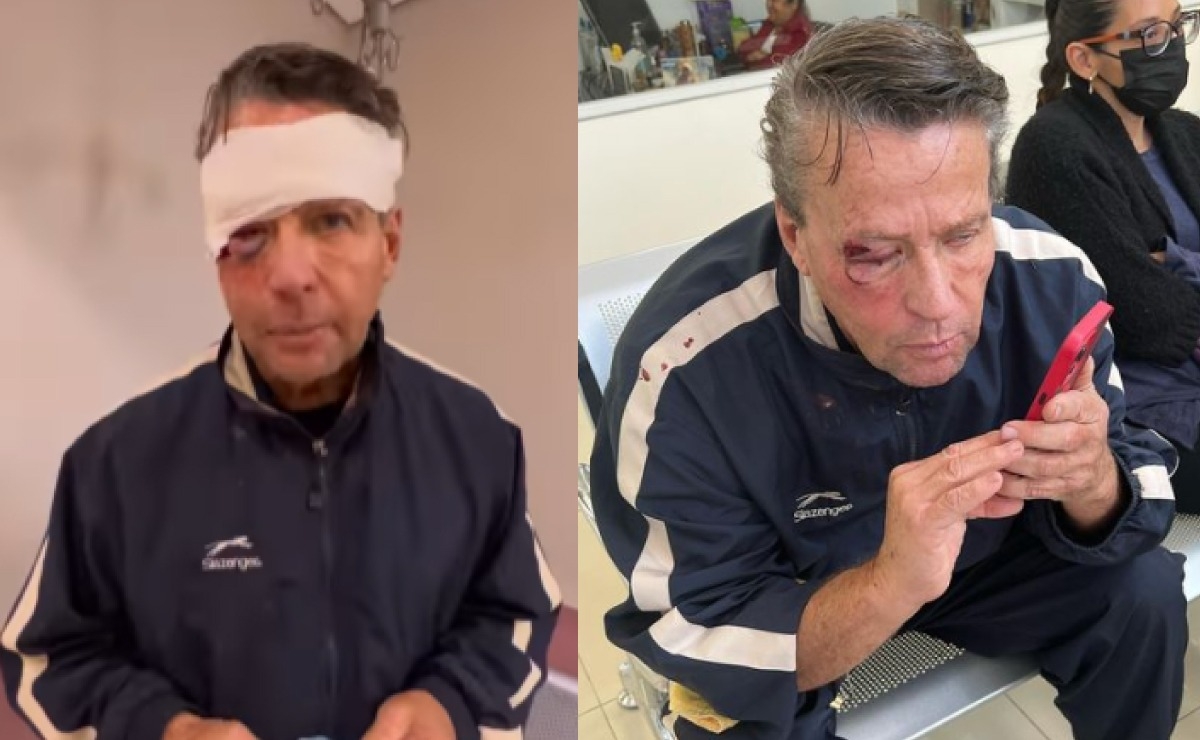 Alfredo Adame comentó que, según un nuevo video, fue agredido con una piedra. Alfredo Adame comentó que, según un nuevo video, fue agredido con una piedra.