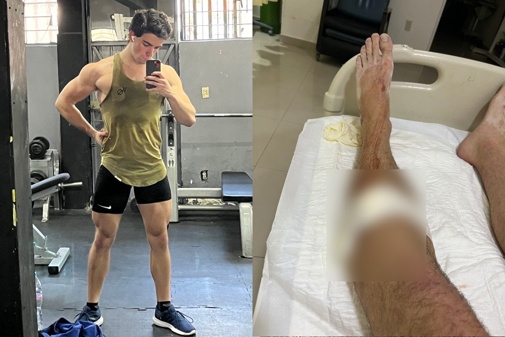 El youtuber deportivo FalBak indicó que el narcomenudista agredió a su amigo, y que luego, tuvieron que correr para evitar ser lastimados por cómplices del delincuente El youtuber deportivo FalBak indicó que el narcomenudista agredió a su amigo, y que luego, tuvieron que correr para evitar ser lastimados por cómplices del delincuente