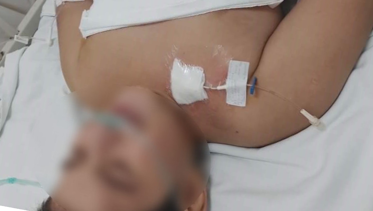 Manuel Trejo sufrió rotura de apéndice y requiere recursos para su costosa recuperación Manuel Trejo sufrió rotura de apéndice y requiere recursos para su costosa recuperación