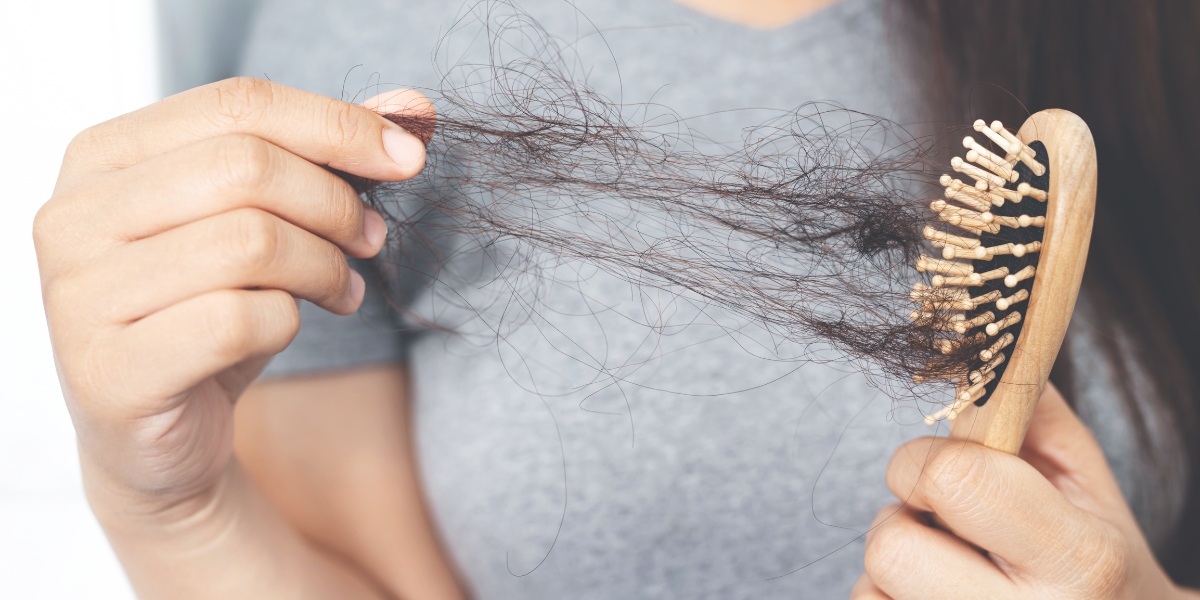 La alopecia no es un tema solo de hombres. Foto: Especial. La alopecia no es un tema solo de hombres. Foto: Especial.