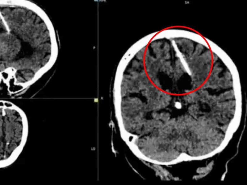 Los médicos aseguran que sus papás intentaron matarla cuando era bebé
