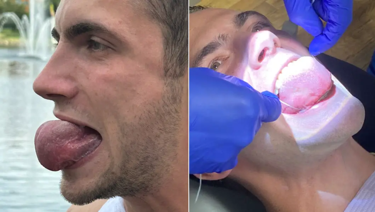 La lengua más ancha. Foto: Especial La lengua más ancha. Foto: Especial