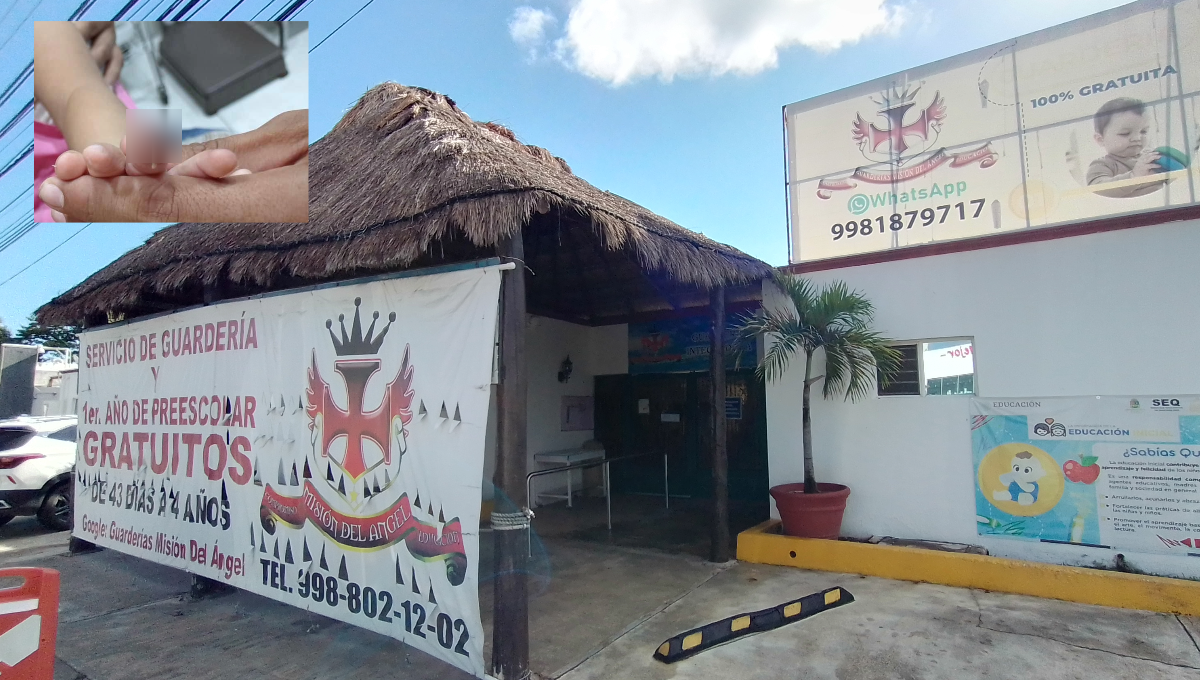 Madre denuncia a una guardería de Cancún luego de que su hija sufrió la amputación de un dedo