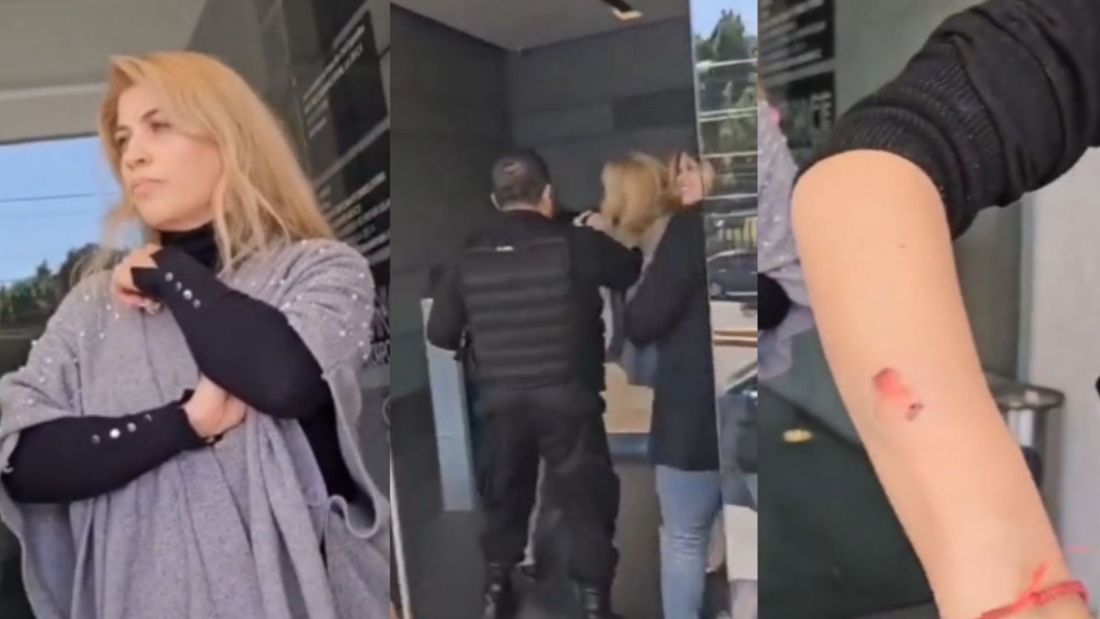 'Lady mordidas' ataca a una empleada en spa de Edomex 'Lady mordidas' ataca a una empleada en spa de Edomex