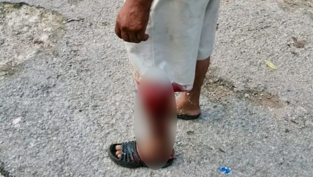 La Policía Municipal exhortó a Tiburcio a que acudiera e interpusiera una denuncia contra su hermano en la Fiscalía General La Policía Municipal exhortó a Tiburcio a que acudiera e interpusiera una denuncia contra su hermano en la Fiscalía General