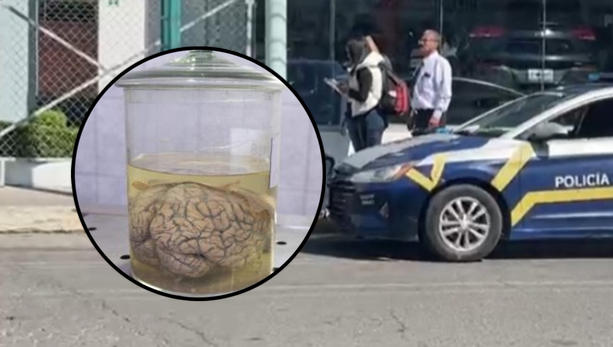 El cerebro se encontraba dentro de un frasco junto a un poste en Toluca El cerebro se encontraba dentro de un frasco junto a un poste en Toluca