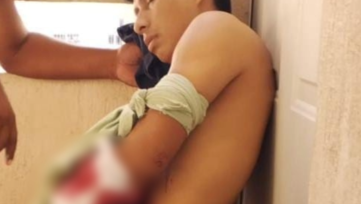 Ciudadanos se percataron de los hechos y evitaron que los malechores terminaran con su vida; llamaron al número de emergencias. Ciudadanos se percataron de los hechos y evitaron que los malechores terminaran con su vida; llamaron al número de emergencias.