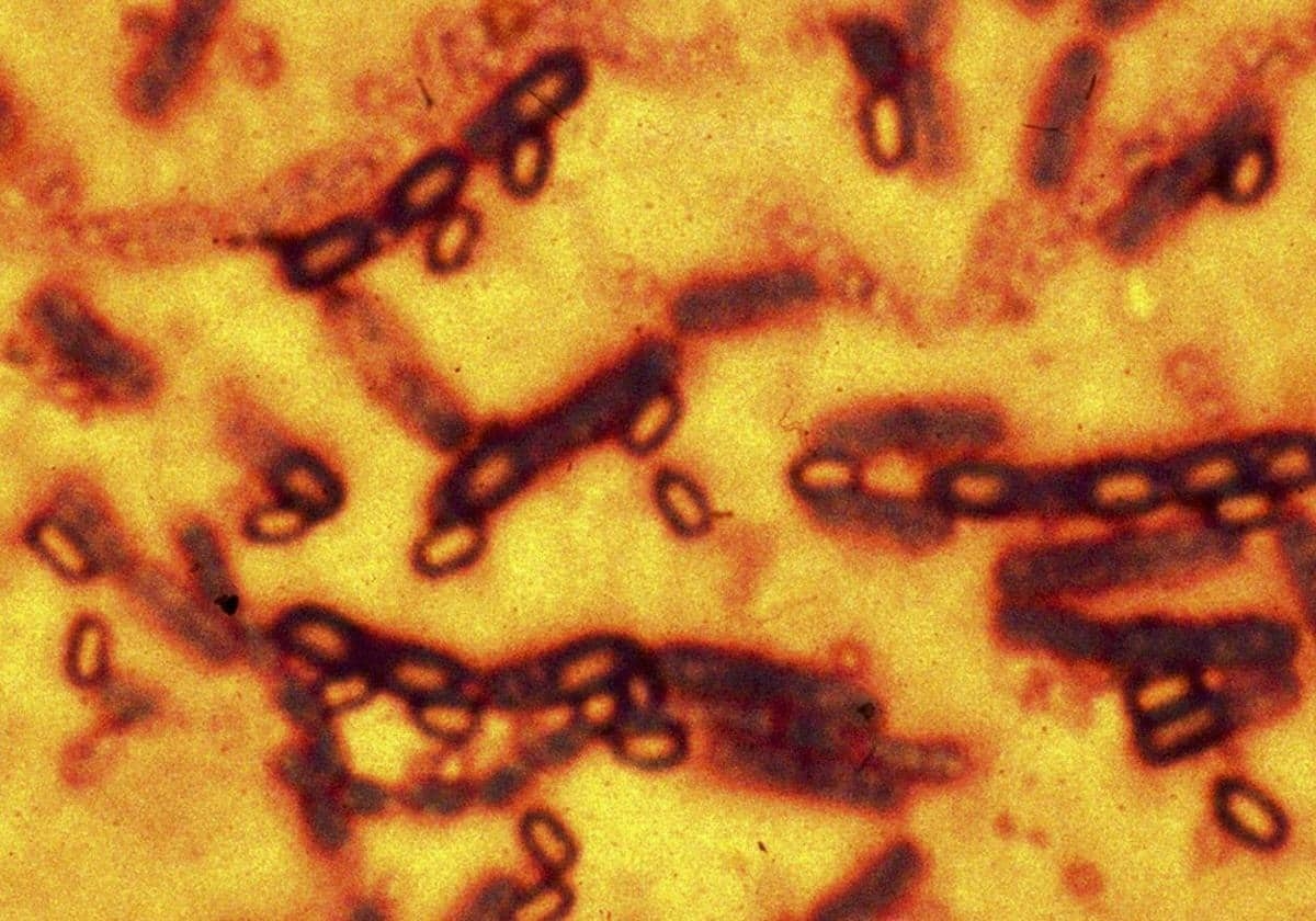 OMS emite alerta por brote del virus ántrax OMS emite alerta por brote del virus ántrax