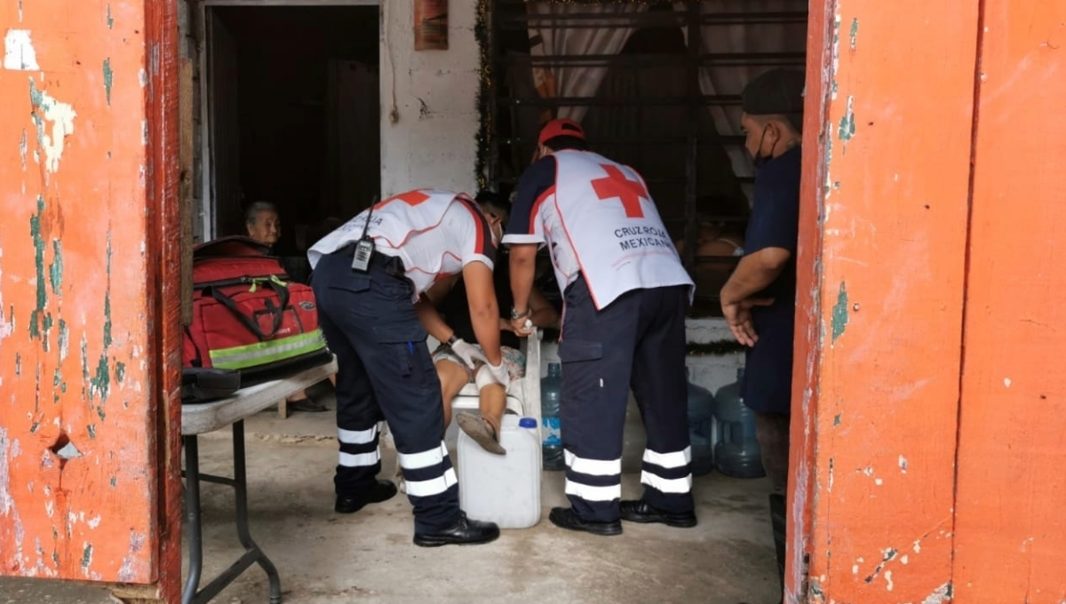 En caso de quemaduras no utilizar remedios caseros porque agravan el problema