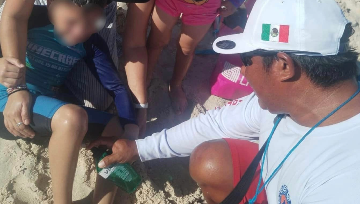 La picadura de estas especies no pone en riesgo la vida, pero resultan dolorosas.