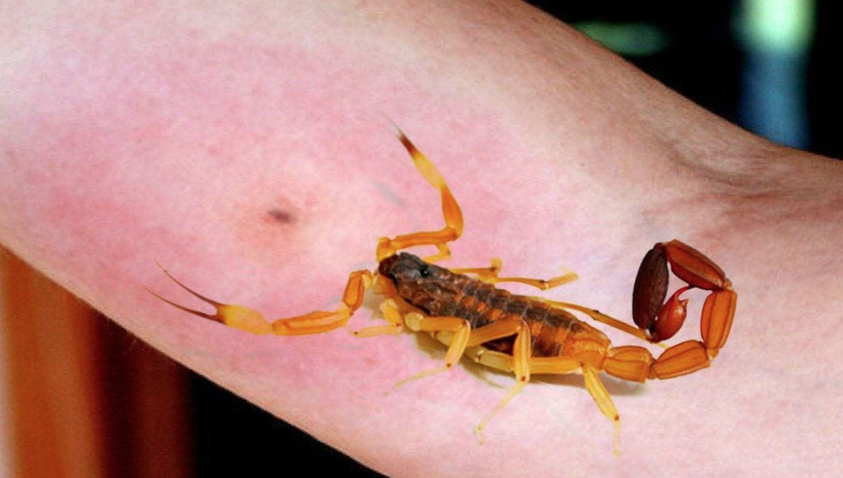 Las afectaciones se producen cuando los insectos o alimañas inoculan toxinas en el organismo y provocan una serie de alteraciones fisiopatológicas