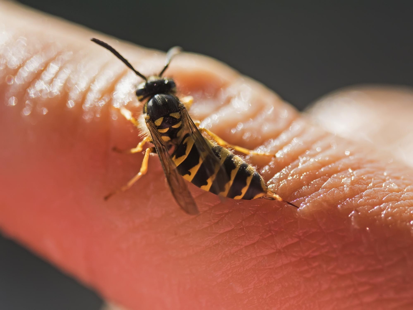 Ser picado por una abeja no es tan malo Ser picado por una abeja no es tan malo
