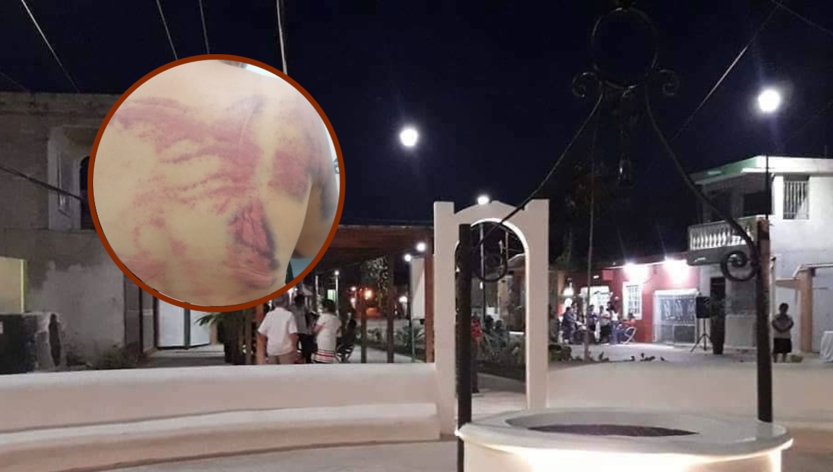 La mujer denunció a su pareja por intento de feminicidio La mujer denunció a su pareja por intento de feminicidio