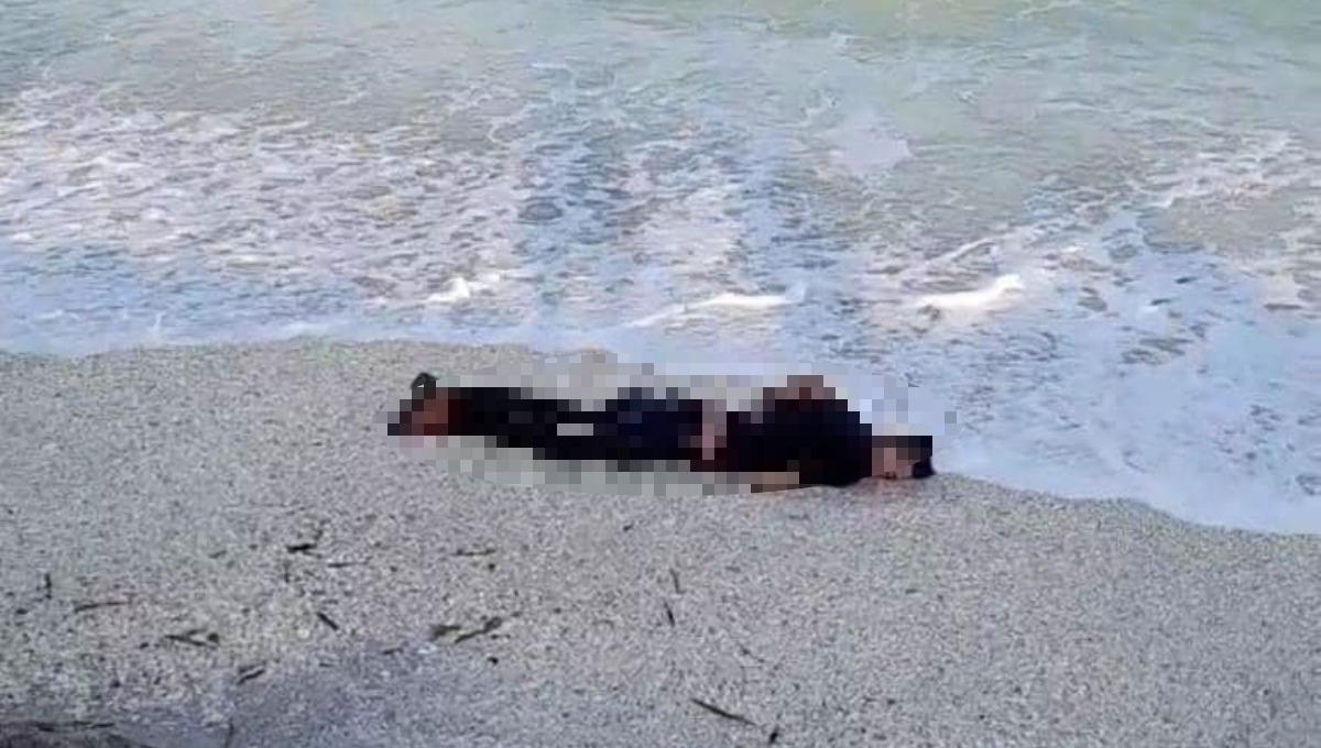 El hombre habría tenido un impacto por arma de fuego en la cabeza El hombre habría tenido un impacto por arma de fuego en la cabeza