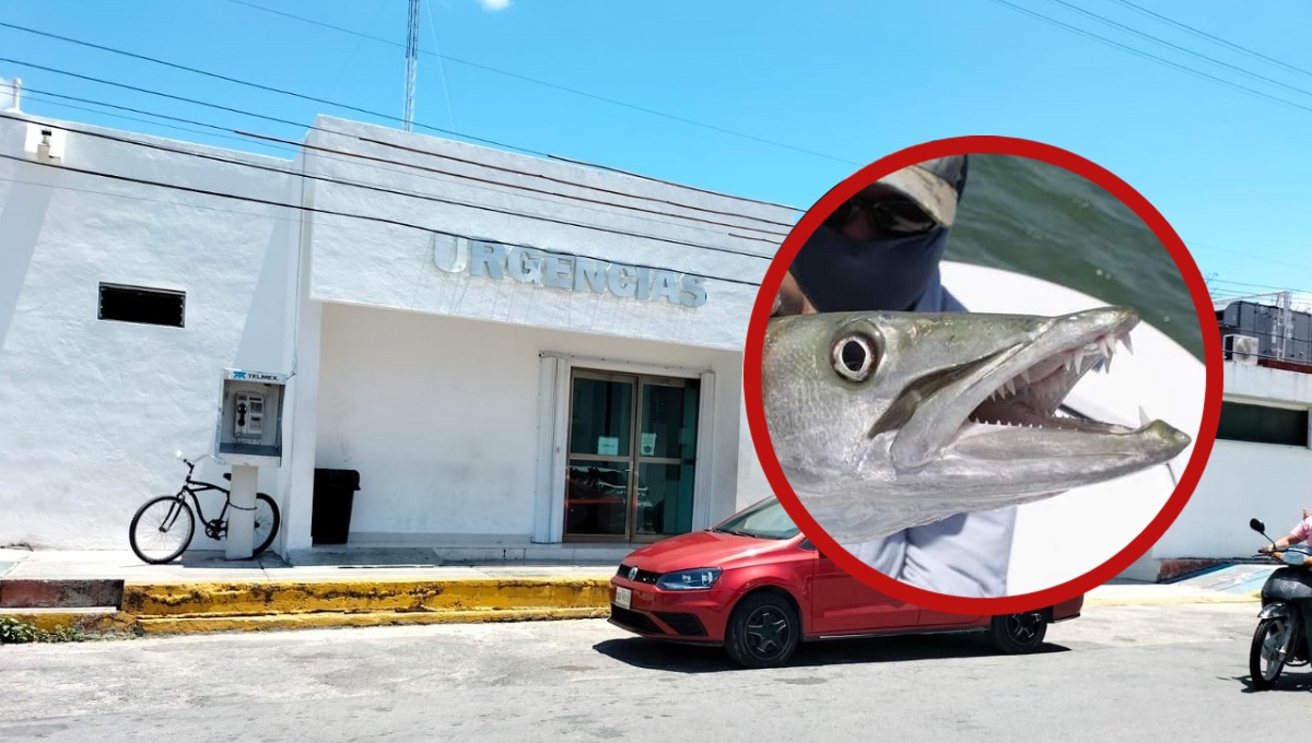 Los peces que comúnmente se consumen en la isla son la barracuda, es por eso que se debe estar atentos de los síntomas Los peces que comúnmente se consumen en la isla son la barracuda, es por eso que se debe estar atentos de los síntomas