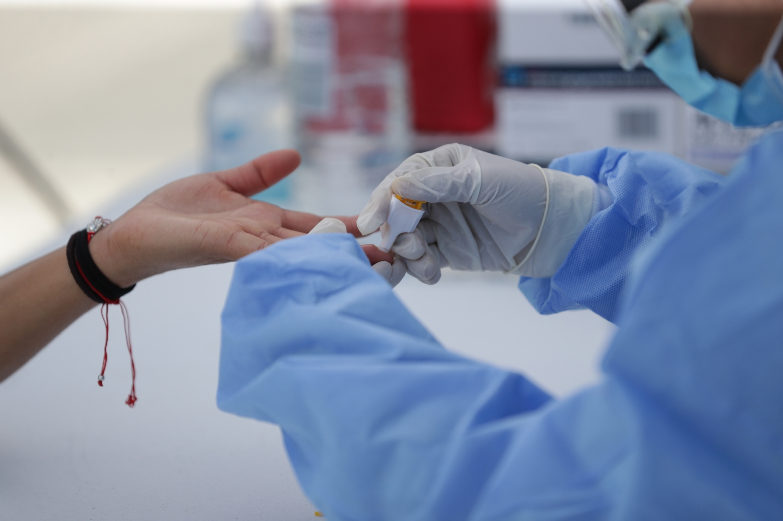 En Yucatán se ha registrado un aumento en casos de hepatitis