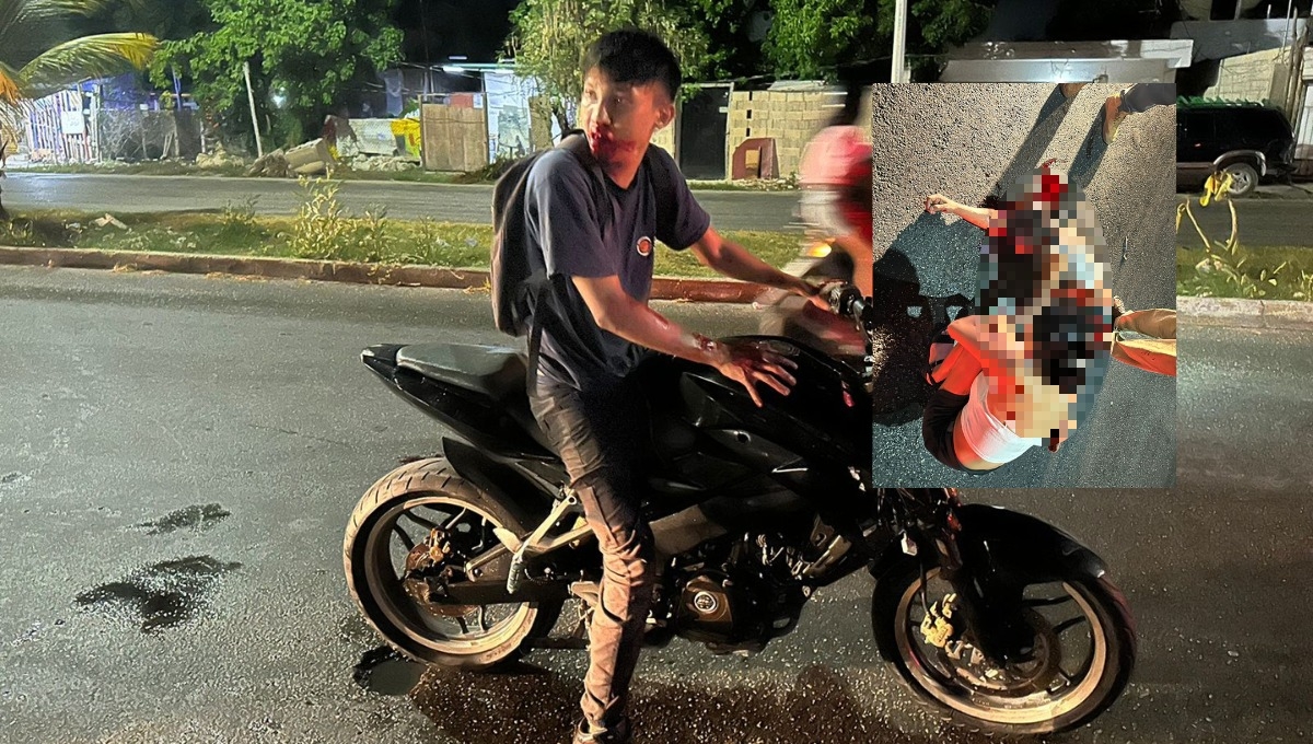 El ciclista sufrió una herida en la cabeza y múltiples fracturas en una de sus piernas El ciclista sufrió una herida en la cabeza y múltiples fracturas en una de sus piernas