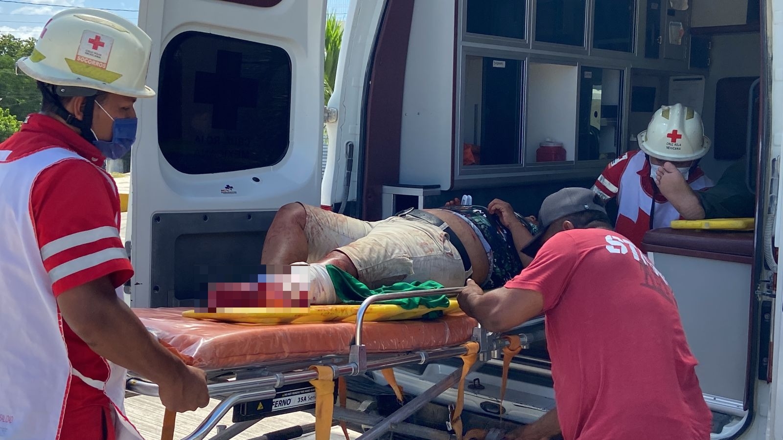 La mujer quedó con la pierna destrozada