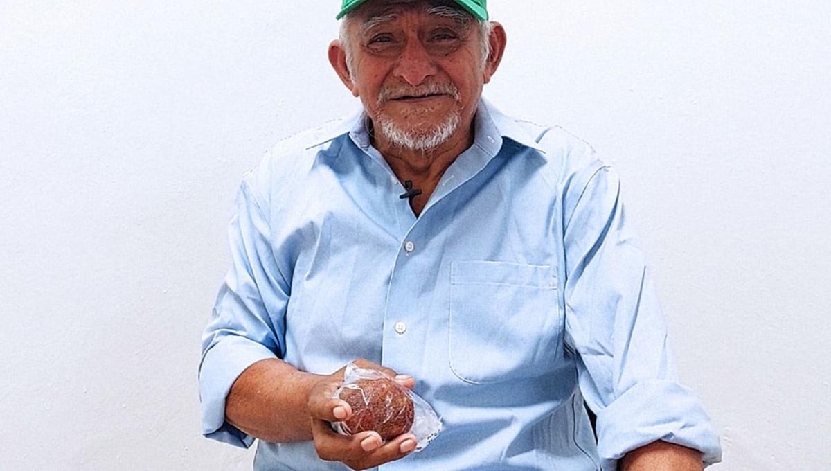 El abuelito presentó fuerte dolor en la vejiga por una enorme piedra