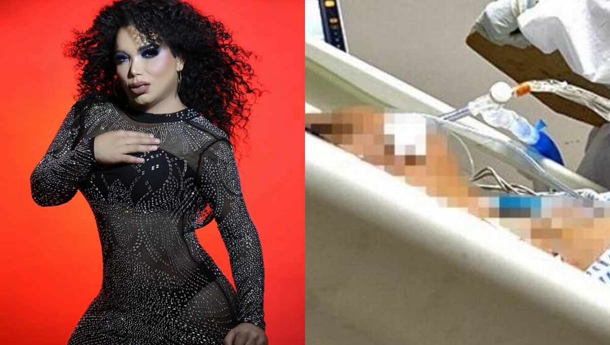 Paola Suárez habría sufrido un accidente tras caer del balcón de un segundo piso Paola Suárez habría sufrido un accidente tras caer del balcón de un segundo piso