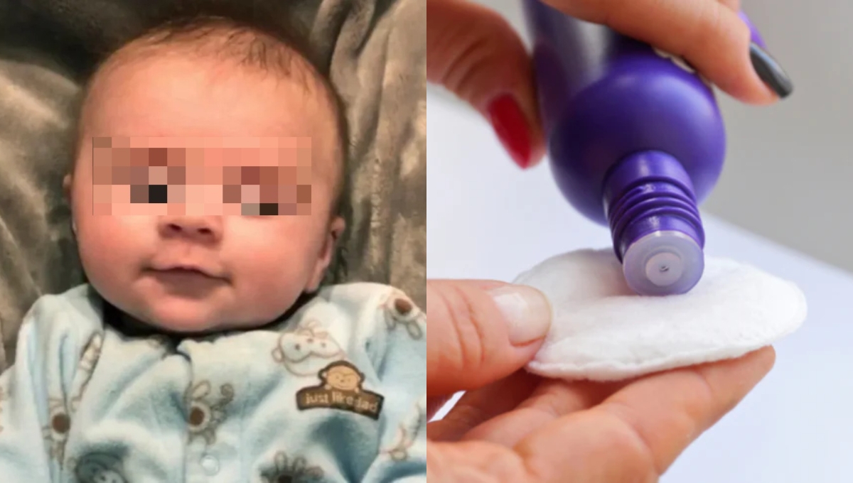 La bebé había consumido baterías, tornillos y acetona proporcionado por la novia de su papá La bebé había consumido baterías, tornillos y acetona proporcionado por la novia de su papá