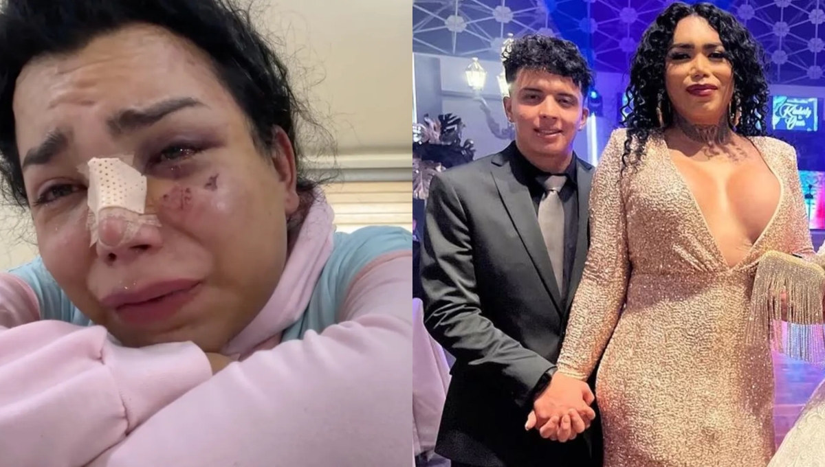 Paolita Suárez se encuentra en su casa recuperándose de los golpes Paolita Suárez se encuentra en su casa recuperándose de los golpes